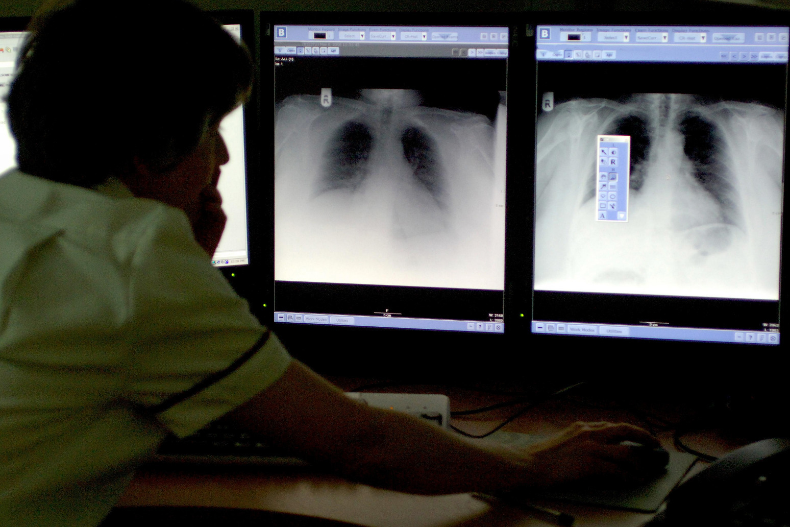 AI could solve NHS radiologist ‘workforce crisis’ 